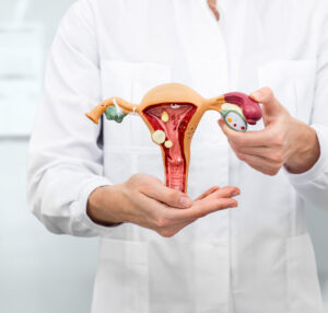 Fibroids