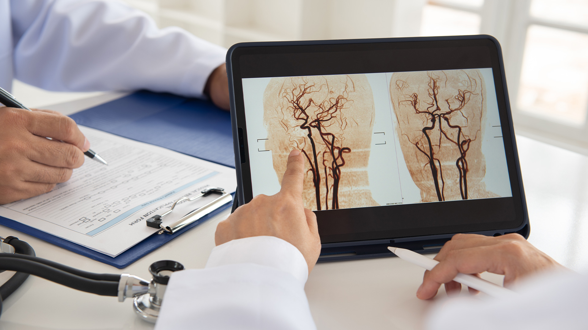 Angiogram (Angiography) in Dubai - CMC